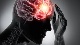 Brain Injury