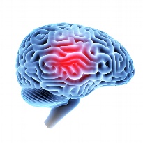 Traumatic Brain Injury & Risk for Opioid Misuse