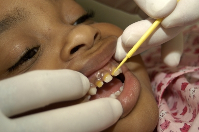 Pediatric Dental Check
