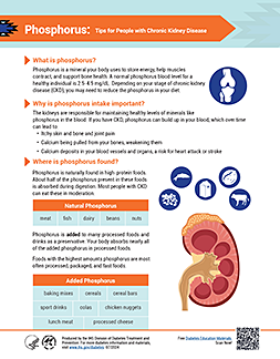 Thumbnail image of Phosphorus: Tips for People with Chronic Kidney Disease