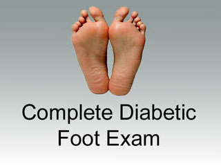 Thumbnail - clicking will open video - Complete Diabetic Foot Exam