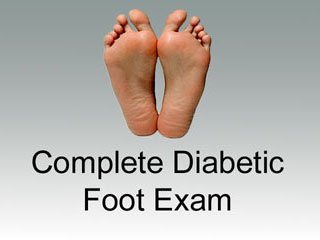 Foot Care Diabetes Standards Of Care And Resources For Clinicians And foot-care-diabetes-standards-of-care-and-resources-for-clinicians-and