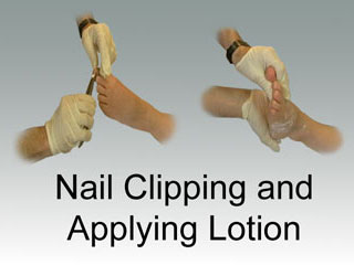 Thumbnail - clicking will open video - Nail Clipping and Applying Lotion