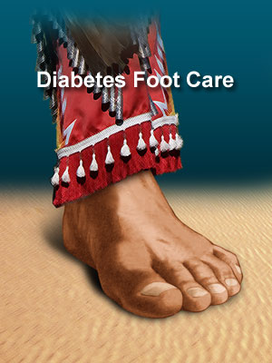 Diabetes Foot Care