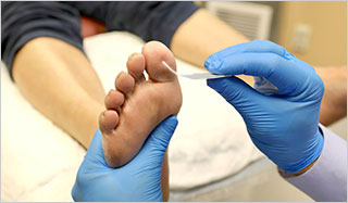 Monofilament exam